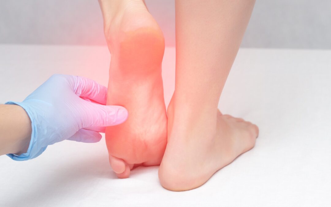 The Role of Podiatrists in Managing Gout