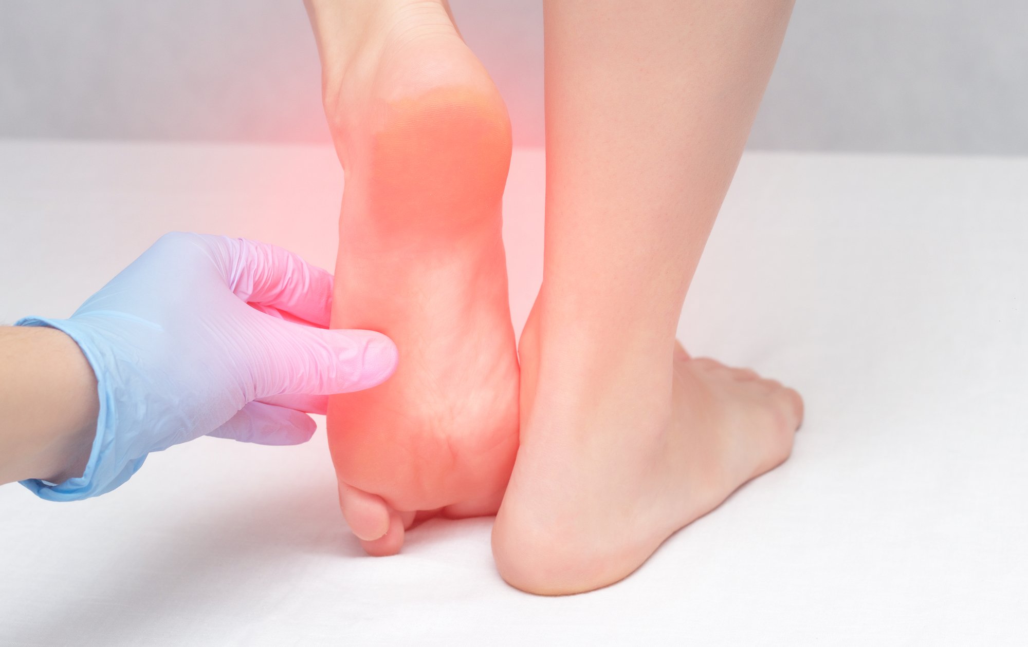 Role of Podiatrists in Managing Gout