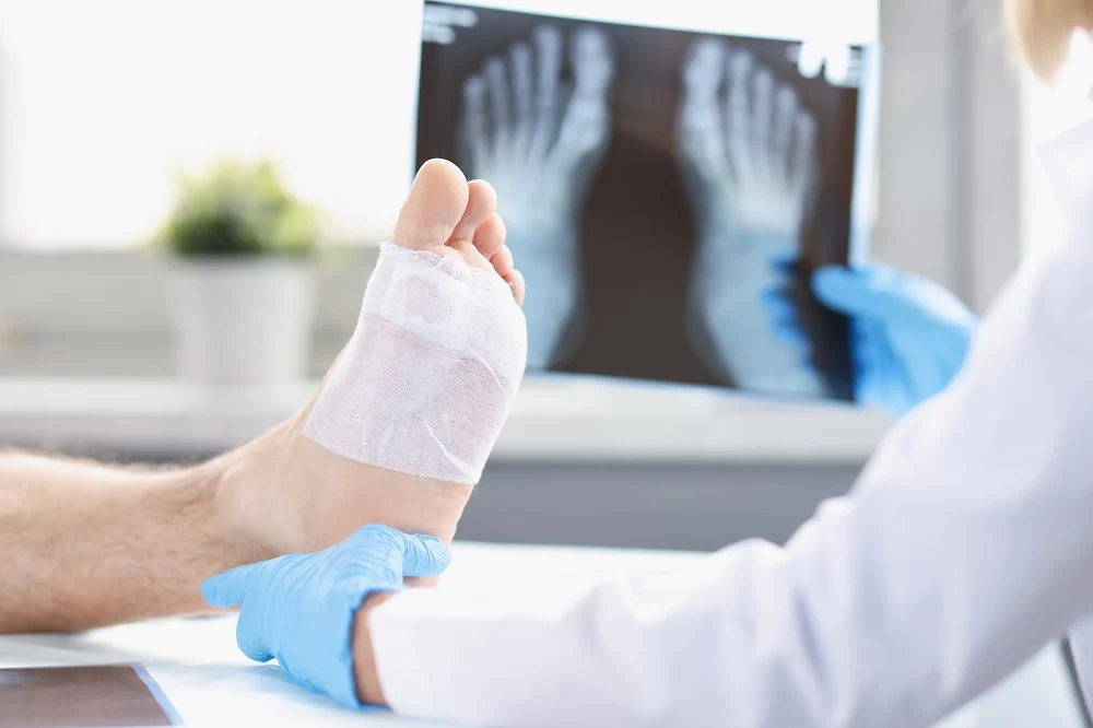 Treating Diabetic Foot Infections: When to See a Podiatrist